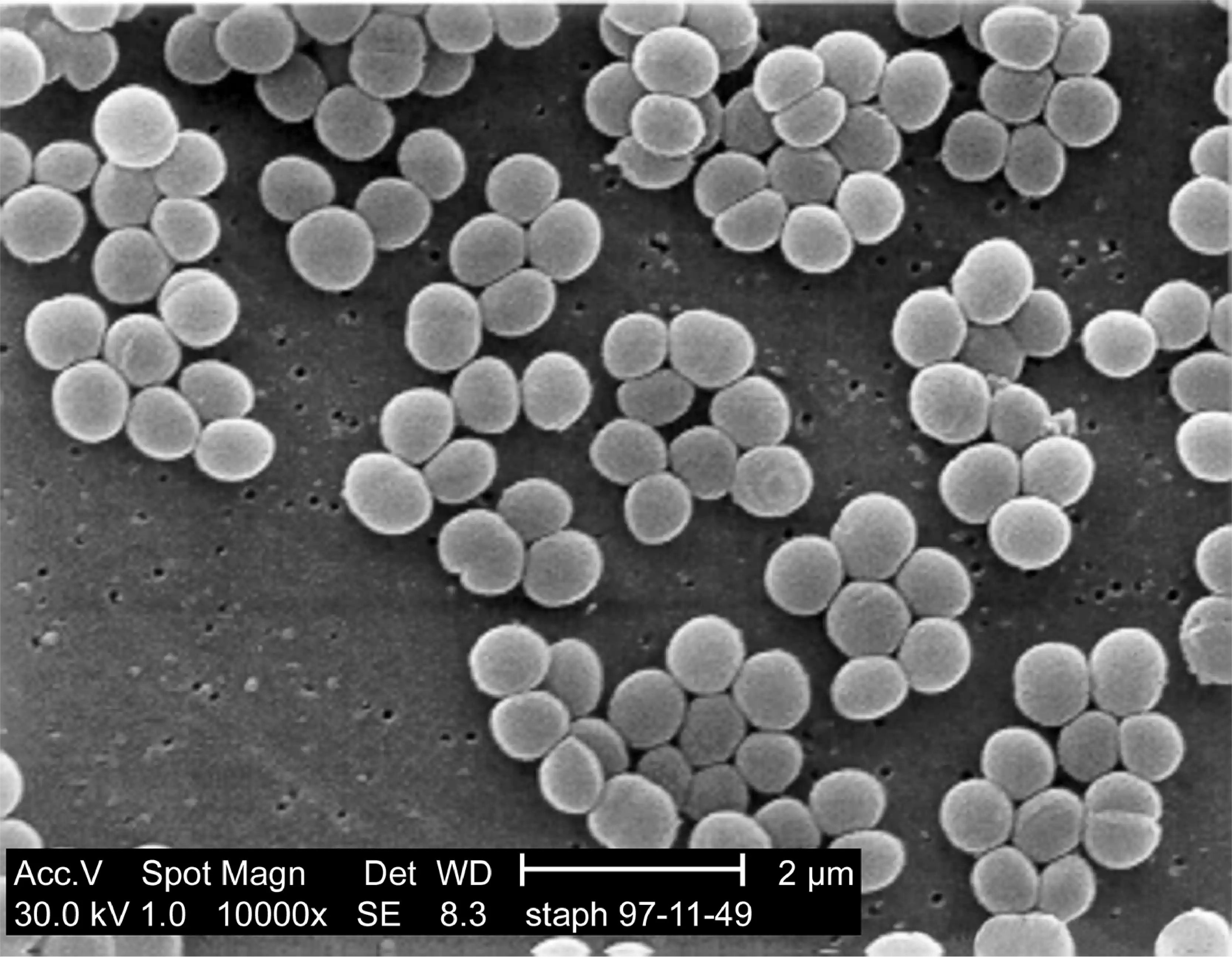 Staphylococcus-aureus